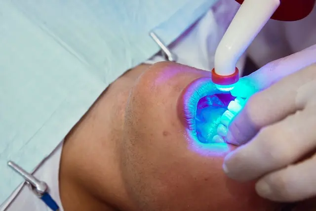paciente realizándose blanqueamiento dental